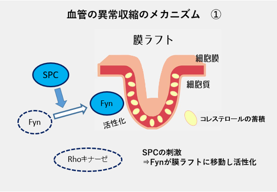 血管の異常収縮のメカニズム1