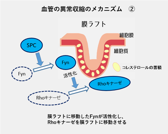 血管の異常収縮のメカニズム2