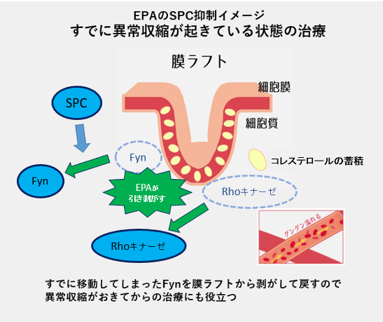 EPAによる血管の異常収縮抑制のメカニズム2